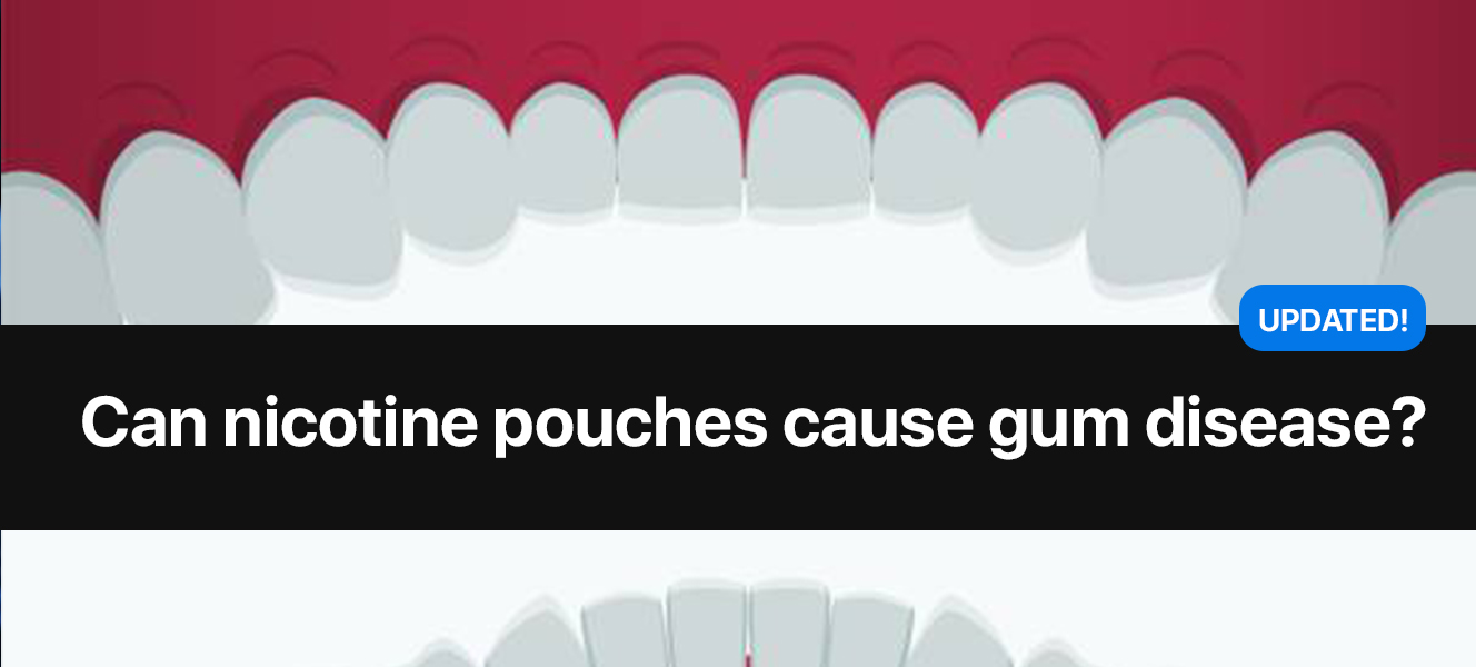 https://www.snusdaddy.eu/media/amasty/blog//75/Can_nicotine_pouches_cause_gum_disease_1.jpg